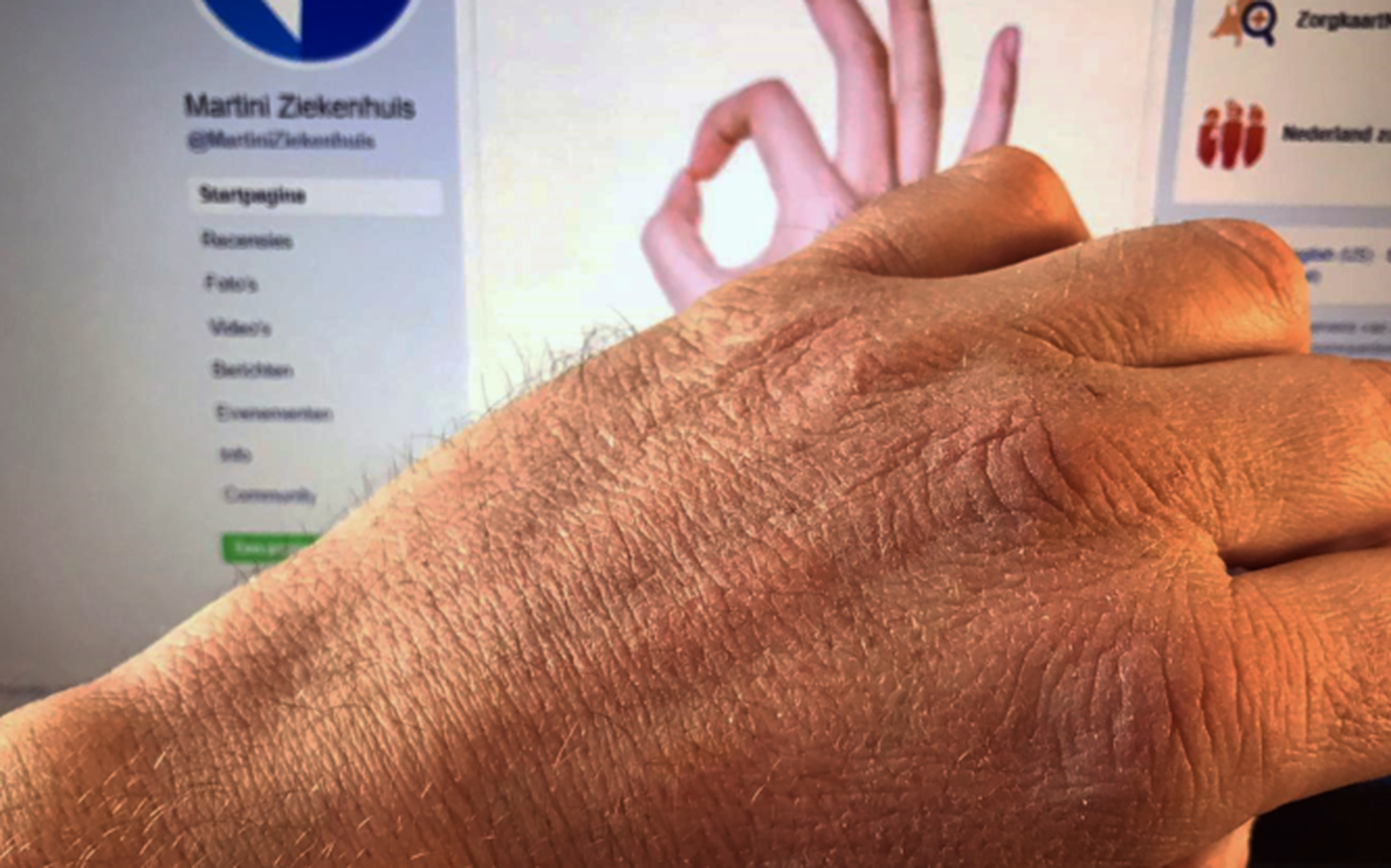 druk Corroderen antenne Vijf tips tegen droge handen van dermatologen van het Martiniziekenhuis -  Sikkom